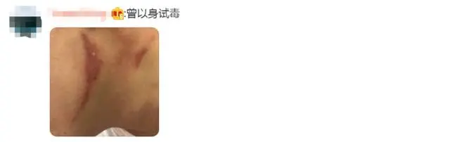 別再關(guān)燈玩手機(jī)了！這種蟲會(huì)毀容！切記不要拍......